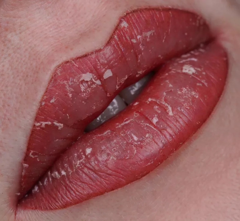 lip shading healing process