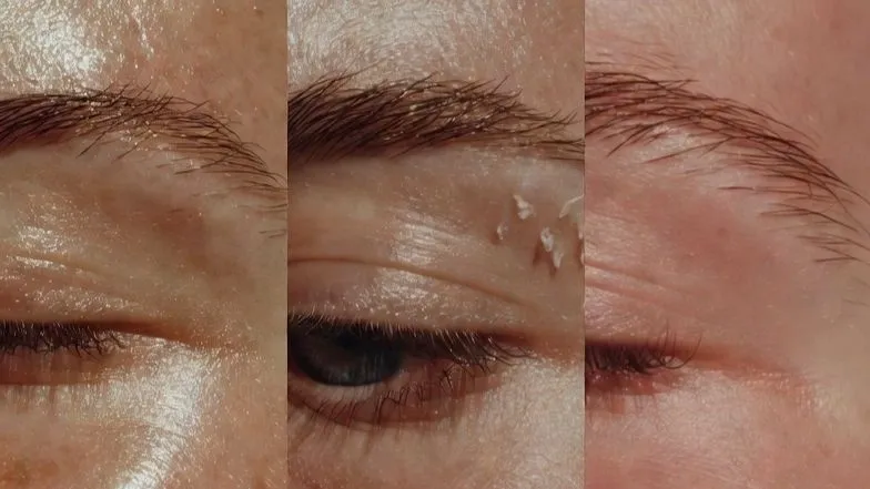 Understanding Skin Types for Microblading Eyebrows