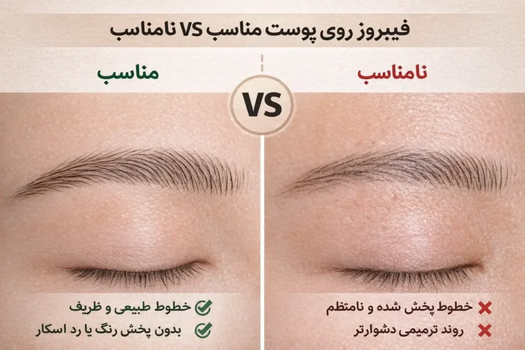 best skin type for phibrows