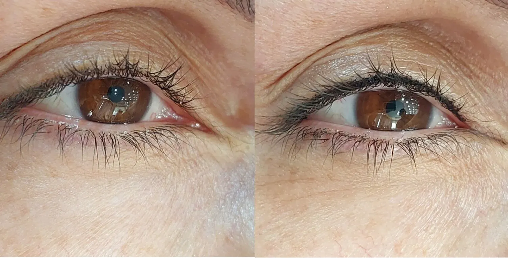 lash line enhancement before after sample