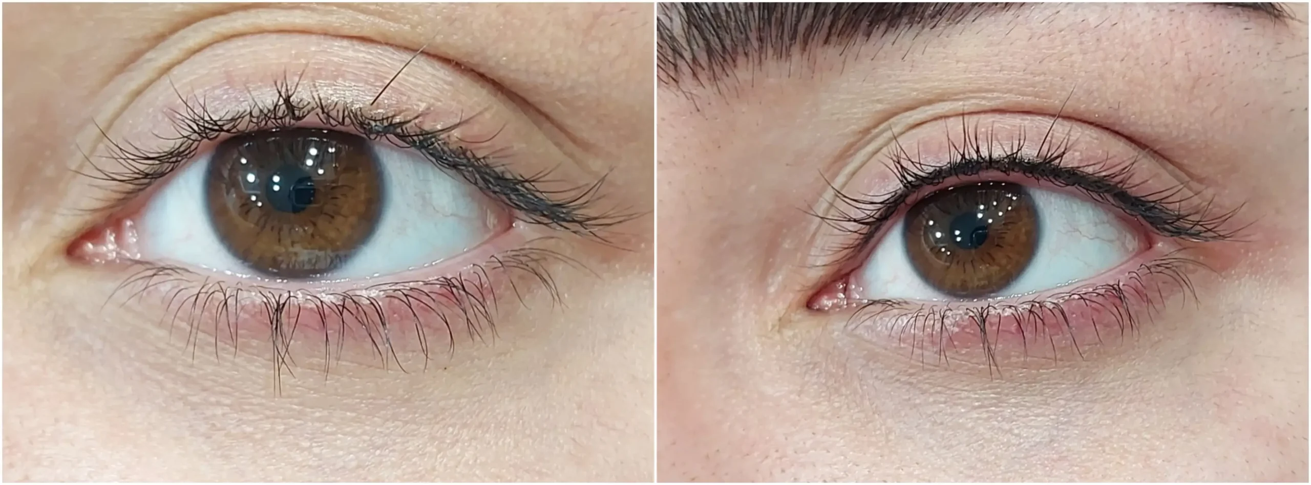 lash line enhancement transformation before and after scaled